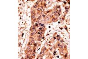 Image no. 2 for anti-Guanylate Cyclase 1, Soluble, alpha 2 (GUCY1A2) (C-Term) antibody (ABIN360707) (GUCY1A2 anticorps  (C-Term))