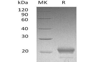 Western Blotting (WB) image for Chemokine (C-X-C Motif) Ligand 15 (CXCL15) protein (His tag) (ABIN7320500)