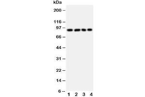 Western blot testing of IL4R antibody and Lane 1:  A431;  2: SMMC-7721;  3: U87;  4: 293T cell lysate. (IL4 Receptor anticorps  (Middle Region))