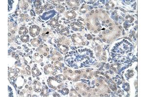 Immunohistochemistry (IHC) image for anti-Phosphoribosyl Pyrophosphate Amidotransferase (PPAT) (N-Term) antibody (ABIN2782471) (PPAT anticorps  (N-Term))