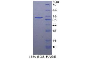 SDS-PAGE analysis of Human vWA1 Protein.