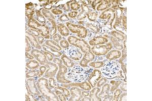 Immunohistochemistry of paraffin-embedded mouse kidney using GC1q R/C1QBP antibody (ABIN7266473) at dilution of 1:25 (40x lens).