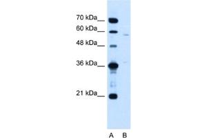 Western Blotting (WB) image for anti-MGC39633 antibody (ABIN2463995) (MGC39633 anticorps)