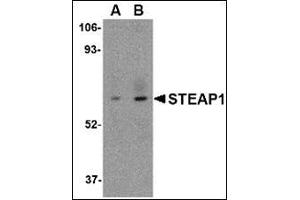 Western blot analysis of STEAP1 in human spleen tissue lysate with this product at (A) 1 and (B) 2 μg/ml. (STEAP1 anticorps  (C-Term))