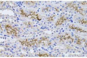 Immunohistochemistry of paraffin-embedded Rat kidney using GGT1 Polyclonal Antibody at dilution of 1:100 (40x lens). (GGT1 anticorps)