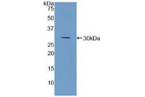 Detection of Recombinant BST1, Human using Polyclonal Antibody to Bone Marrow Stromal Cell Antigen 1 (BST1) (BST1 anticorps  (AA 63-313))