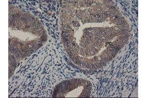 Image no. 2 for anti-Copper Metabolism (Murr1) Domain Containing 1 (COMMD1) antibody (ABIN1497561)