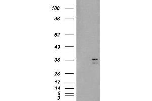 Western Blotting (WB) image for Sirtuin 4 (SIRT4) peptide (ABIN370464)