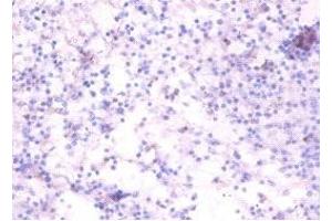 Immunohistochemistry of paraffin-embedded human spleen tissue using ABIN7173868 at dilution of 1:100