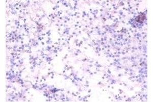Immunohistochemistry of paraffin-embedded human spleen tissue using ABIN7173868 at dilution of 1:100 (RELT anticorps  (AA 26-153))