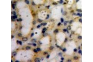 IHC-P analysis of Kidney tissue, with DAB staining. (COL6A1 anticorps  (AA 828-1022))
