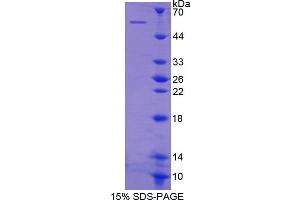 SDS-PAGE analysis of Human Integrin beta 1 Protein. (ITGB1 Protéine)