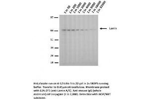 Image no. 1 for anti-Lamin A/C (LMNA) (Arg453Trp-Mutant) antibody (ABIN1042618) (Lamin A/C anticorps  (Arg453Trp-Mutant))