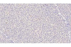 Detection of ANGPT1 in Human Liver Tissue using Polyclonal Antibody to Angiopoietin 1 (ANGPT1)