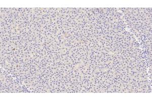 Detection of ANGPT1 in Human Liver Tissue using Polyclonal Antibody to Angiopoietin 1 (ANGPT1) (Angiopoietin 1 anticorps  (AA 284-452))