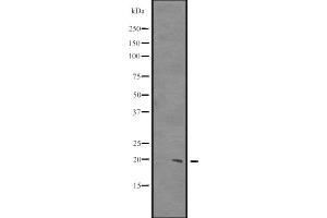 Western blot analysis of CIRBP expression in HCT116 whole cell lysate ,The lane on the left is treated with the antigen-specific peptide. (CIRBP anticorps  (C-Term))