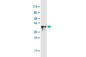 Western Blot detection against Immunogen (37. (ZNF100 anticorps  (AA 99-206))