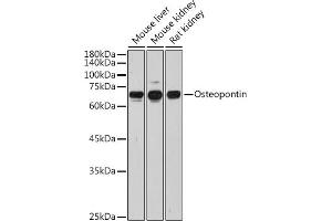 Western blot analysis of extracts of various cell lines, using Osteopontin antibody (ABIN3021921, ABIN3021922, ABIN3021923 and ABIN6217674) at 1:1000 dilution. (Osteopontin anticorps  (AA 17-314))
