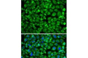 Immunofluorescence analysis of A-549 cells using SAT2 Polyclonal Antibody (SAT2 anticorps)