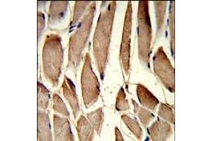 Formalin-fixed and paraffin-embedded human skeletal muscle reacted with RRM2 Antibody (Center), which was peroxidase-conjugated to the secondary antibody, followed by DAB staining.