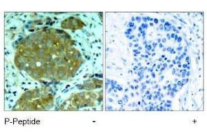Image no. 1 for anti-Nuclear Factor of kappa Light Polypeptide Gene Enhancer in B-Cells 1 (NFKB1) (pSer932) antibody (ABIN197008) (NFKB1 anticorps  (pSer932))