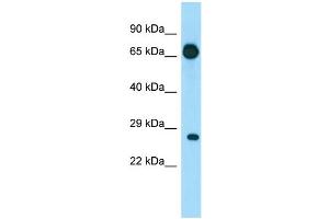 WB Suggested Anti-EIF4E1B Antibody Titration: 1. (EIF4E1B anticorps  (N-Term))