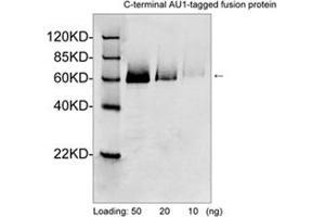 Western blot analysis of AU1 tagged fusion proteins expressed in E. (AU1 Epitope Tag anticorps)