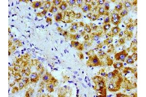 Immunohistochemistry of paraffin-embedded human liver tissue using ABIN7168945 at dilution of 1:100
