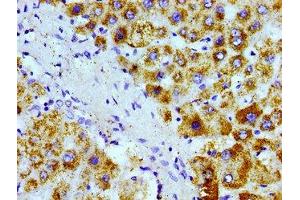 Immunohistochemistry of paraffin-embedded human liver tissue using ABIN7168945 at dilution of 1:100 (AGXT anticorps  (AA 112-294))