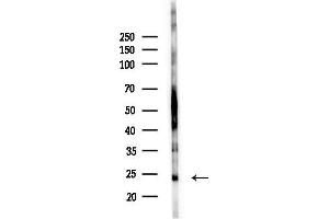 anti-Cerebellin 1 Precursor (CBLN1) (C-Term) antibody