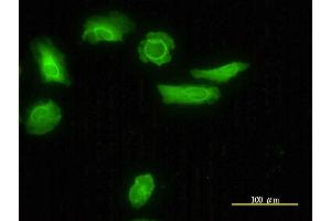 Immunofluorescence of monoclonal antibody to LDLRAP1 on HeLa cell.