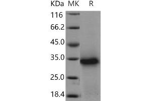 Western Blotting (WB) image for Twisted Gastrulation Homolog 1 (TWSG1) protein (His tag) (ABIN7320390)