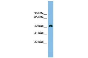 ANKRD42 antibody used at 1 ug/ml to detect target protein. (ANKRD42 anticorps  (N-Term))