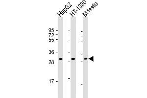 All lanes : Anti-ZT3 Antibody (Center) at 1:8000 dilution Lane 1: HepG2 whole cell lysate Lane 2: HT-1080 whole cell lysate Lane 3: mouse testis lysate Lysates/proteins at 20 μg per lane.