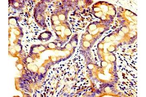 IHC image of ABIN7164820 diluted at 1:300 and staining in paraffin-embedded human small intestine tissue performed on a Leica BondTM system.