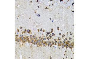Immunohistochemistry of paraffin-embedded mouse brain using EFNB2 antibody (ABIN5973311) at dilution of 1/100 (40x lens). (Ephrin B2 anticorps)