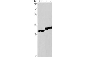Western Blotting (WB) image for anti-2,4-Dienoyl CoA Reductase 1, Mitochondrial (DECR1) antibody (ABIN2434542) (DECR1 anticorps)