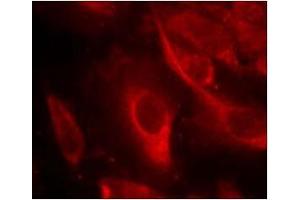 Image no. 2 for anti-Mitogen-Activated Protein Kinase Kinase 6 (MAP2K6) (pSer207) antibody (ABIN196864)