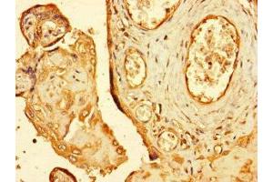 Immunohistochemistry of paraffin-embedded human placenta tissue using ABIN7151194 at dilution of 1:100 (RNF4 anticorps  (AA 1-103))