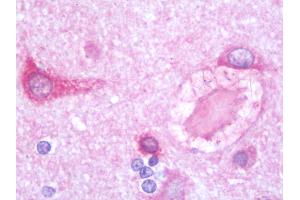 Anti-PSPLA1 / PLA1A antibody IHC staining of human brain, cortex. (PSPLA1 / Phospholipase A1 (C-Term) anticorps)
