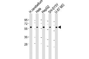 All lanes : Anti-H Antibody (Center) at 1:1000-1:2000 dilution Lane 1: Human cerebellum lysate Lane 2: Hela whole cell lysate Lane 3: HepG2 whole cell lysate Lane 4: SH-SY5Y whole cell lysate Lane 5: U-87 MG whole cell lysate Lysates/proteins at 20 μg per lane. (AMH anticorps  (AA 424-451))