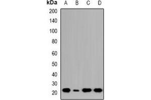 Western blot analysis of NTPCR expression in HCT116 (A), Jurkat (B), COLO205 (C), LO2 (D) whole cell lysates. (C1orf57 anticorps  (C-Term))