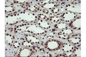 Image no. 3 for anti-Replication Factor C (Activator 1) 2, 40kDa (RFC2) (AA 1-234) antibody (ABIN1490617)