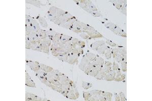 Immunohistochemistry of paraffin-embedded mouse heart using CTCF antibody. (CTCF anticorps)