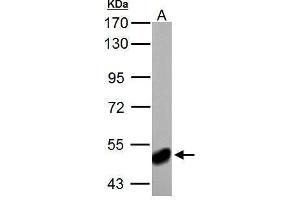 WB Image ABAT antibody detects ABAT protein by Western blot analysis. (ABAT anticorps)