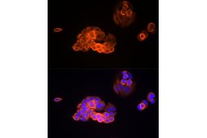 Immunofluorescence analysis of MCF7 cells using MMP13 Rabbit mAb (ABIN7268419) at dilution of 1:100 (40x lens). (MMP13 anticorps)