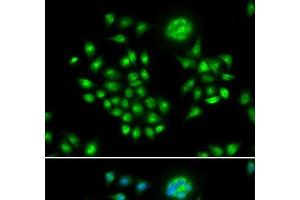 Immunofluorescence analysis of HeLa cells using AGFG1 Polyclonal Antibody (AGFG1 anticorps)