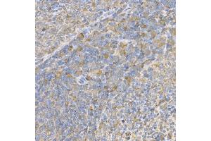 Immunohistochemistry of paraffin-embedded rat spleen using Caspase-3 Rabbit pAb (ABIN6134639, ABIN6137978, ABIN6137979 and ABIN6215159) at dilution of 1:100 (40x lens).