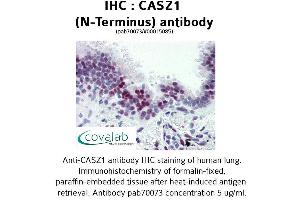 Image no. 1 for anti-Castor Zinc Finger 1 (CASZ1) (N-Term) antibody (ABIN1732691) (CASZ1 anticorps  (N-Term))