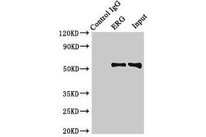 Immunoprecipitating ERG in Rat heart tissue Lane 1: Rabbit control IgG (1 μg) instead of ABIN7172771 in Rat heart tissue. (ERG anticorps  (AA 1-486))